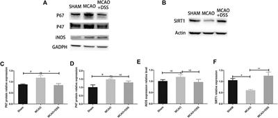 Danggui-Shaoyao-San (DSS) Ameliorates Cerebral Ischemia-Reperfusion Injury via Activating SIRT1 Signaling and Inhibiting NADPH Oxidases